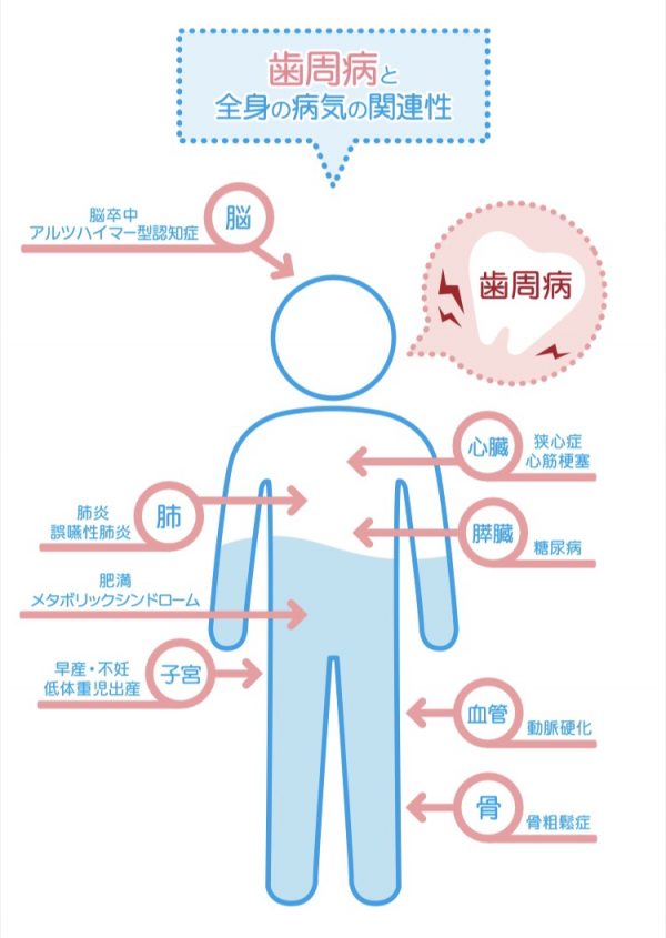 汐留シティセンター歯科　歯周病治療　全身の病気との関係