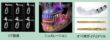 基本診査